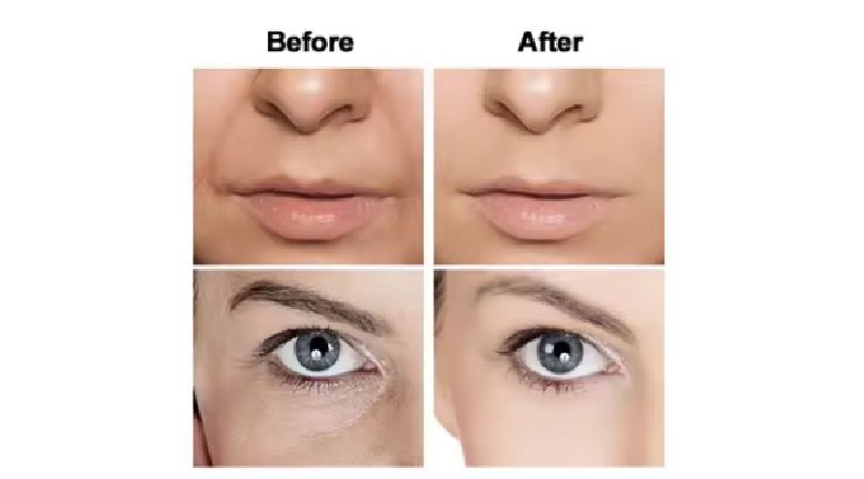 When you need try aesthetic beauty
