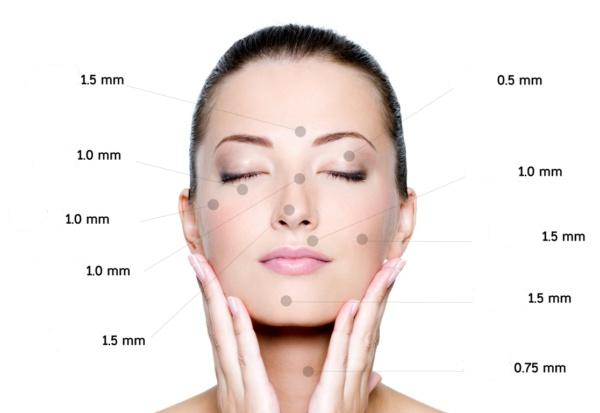 The principle of derma roller needles