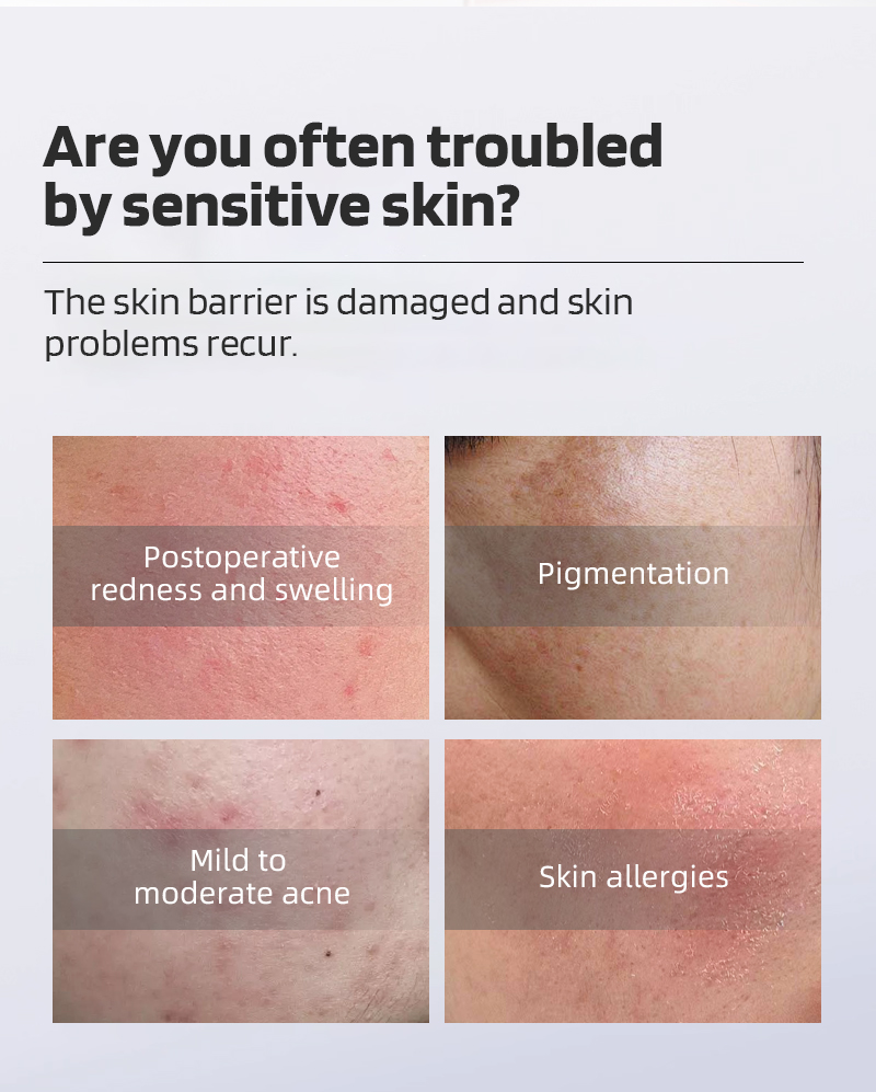 Conpuvon repair facial mask (2).jpg